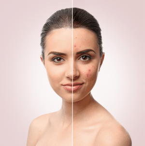 All About Typical Skin Disorders