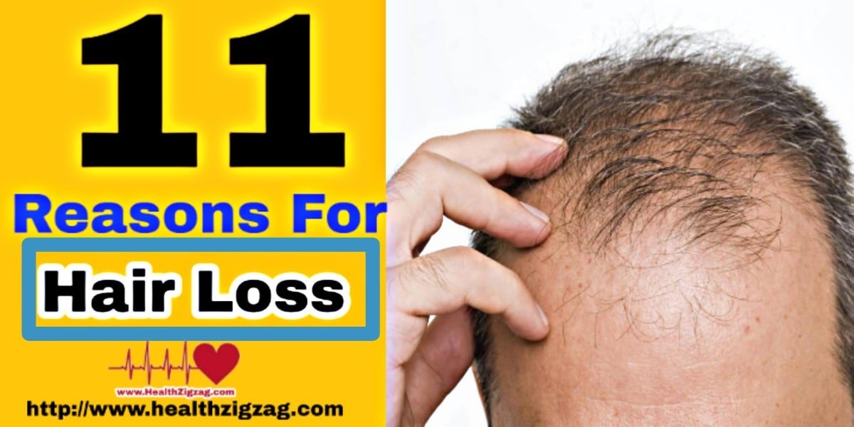 reasons for hair loss