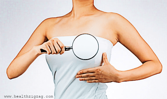 remedies to get rid of a rash under the breasts