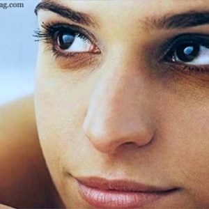 5 ways to get rid of dark circles under the eyes