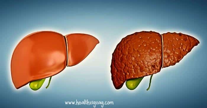 How to repair liver damage