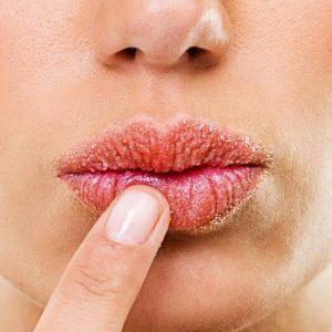 Reasons that why do lips dry out?