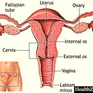 Female genital prolapse: what is the reason?