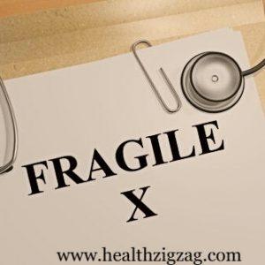 fragile x syndrome symptoms and treatments