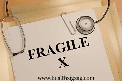 fragile x syndrome symptoms and treatments