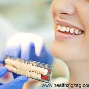 common misconceptions about dental implants