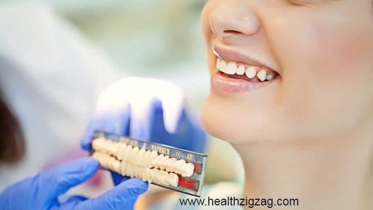 common misconceptions about dental implants